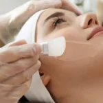 Chemical Peels by Armé Wellness in Kingsport TN